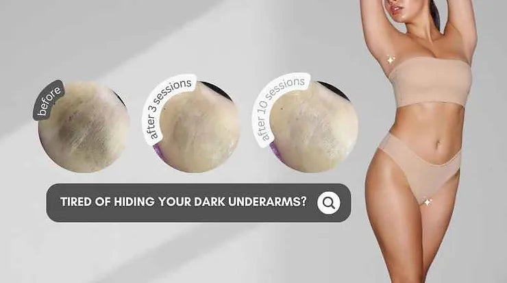 How to Get Rid of Dark Armpits Fast?